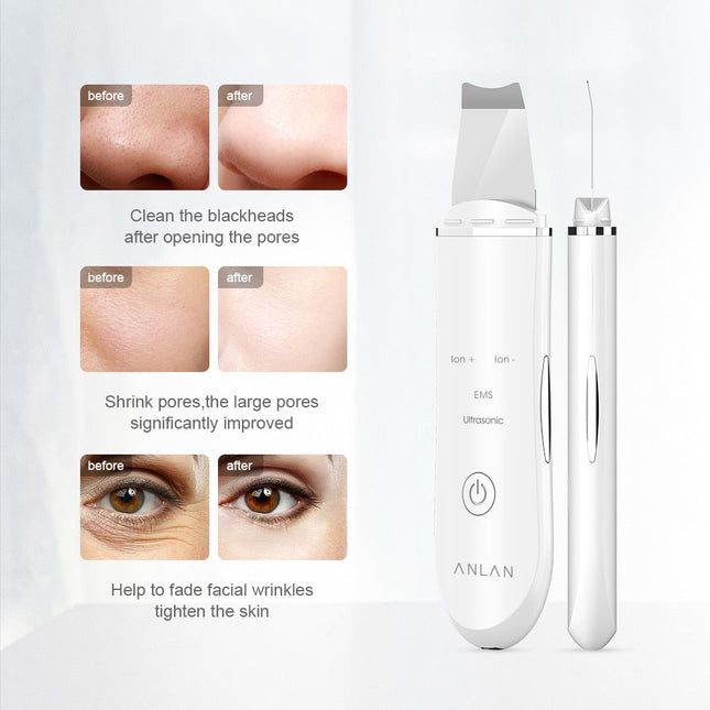 Ultrasonic Skin Scrubber Deep Face Cleaning